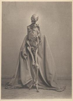 Photograph of found bog body of 1873. The body had been found