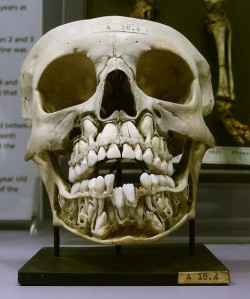 sovyetbritva:  Human child’s skull, before losing their baby-teeth.