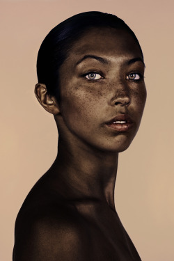 burnagain:  soldsoulglenx:  Amazing Freckles Portrait Series
