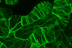 frontal-cortex:  Actin microfilaments in epidermal cells of an