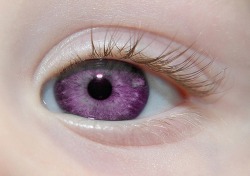 Alexandria’s Genesis, also known as ”violet eyes” (a mutation).
