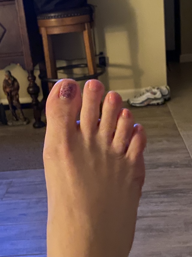 lickitysplittz69-deactivated202:Worship my feet,toes.. there
