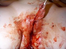 pussymodsgaloreNot for the squeamish! A woman who consented to