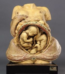   This remarkable 18th-century wax anatomical model comes from