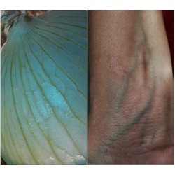 bodycomparative:  -