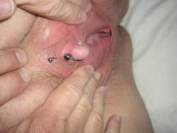 pussymodsgaloreShe has a VCH piercing with a curved barbell.