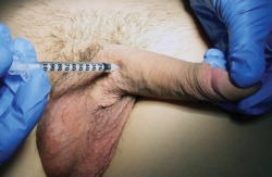 circumcisedperfection:  Circumcision performed on an erect penis!