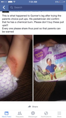 wanderingobsidian:  These are giving babies chemical burns!!!