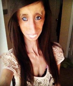 sombre-esprit:  driven-to-the-edge:  leprusse:  candykissesonmytongue:  When she was in high school, Lizzie Velasquez was dubbed “The World’s Ugliest Woman” in an 8-second-long YouTube video. Born with a medical condition so rare that just two other