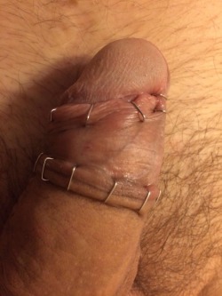 foreskin2cut:Master tortured my foreskin. He stalked it back