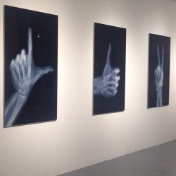 radnoir:  @nickveaseyxray  #art #xray #xrayart #skeleton #skeletalhand