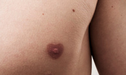 coltre:  Heart shaped nipple 