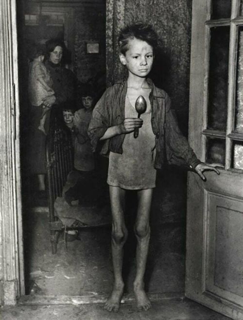 A 9-Year-Old Boy From Amsterdam During The Dutch famine better