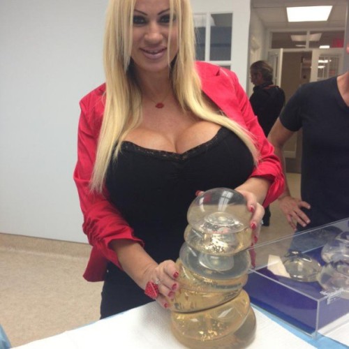 laceywildd:  #bigbreast #plasticsurgery #BUSTY #BLONDE #IMPLANTS #bodymodification #fetish the dr says ihave more than all these together cant wait to see them at 5500cc