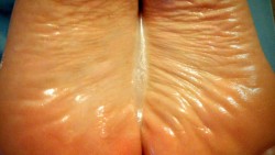 sweetcandytoes:  Close up of her oily, wrinkled soles with my