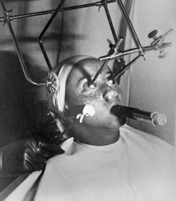 Freckle Removal circa 1930.