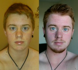 accio-aj:  7 months on T vs 2 years 7 months