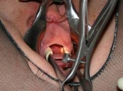 pussymodsgaloreA vaginal speculum holds her pussy open, and then