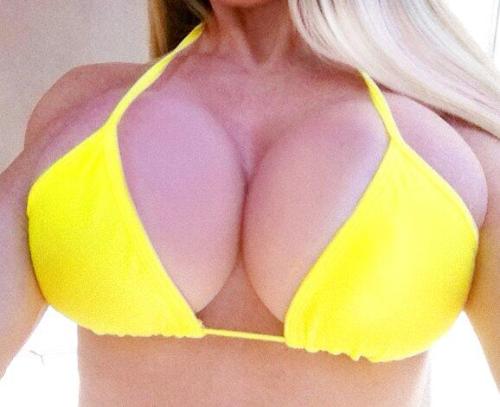 faketitsorbust:  Nice set of fake tits. Good first implants.  Exactly. Wait til she gets addicted.