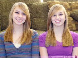 sixpenceee:Mirror Image TwinAround 25% of identical twins develop
