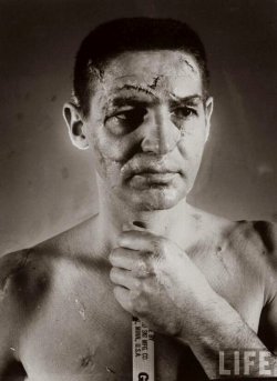 aiiaiiiyo:  Terry Sawchuk – The face of a hockey goalie before