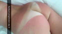 sunshineandbjs:  Thanks for the skin cancer Hawaii 😽