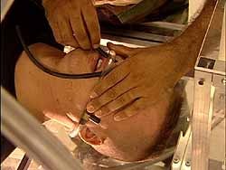 fredmerz:  Inserting the gas breathing tubes into victim’s