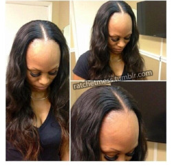 ratchetmess:  She literally has room for a whole other face on