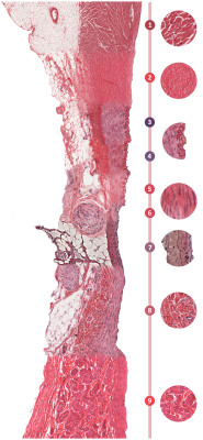 i-heart-histo:  The Seamless Blood Vessel by i-heart-histo  For