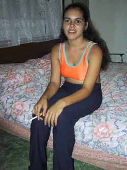 hairy-teeners:  17yo from Cuba 