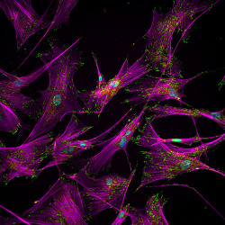 natureofnature:  Image shows adult human fibroblast cells with