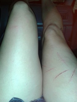 I self harmed a couple days ago. I like thigh scars and I am