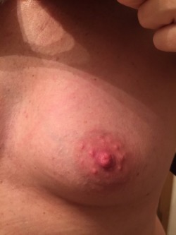 dwb02:  #nipple