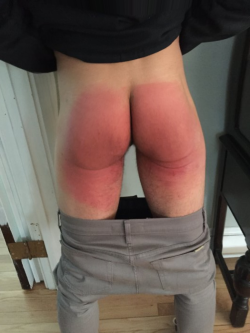 bihan56:  genuinespankings:  Whoever spanked this boy did a good