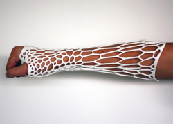 fuckyeahmedicalstuff:  3D-printed, recyclable ‘Cortex’ cast,