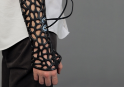kqedscience:  A 3D Printed Cast That Can Heal Your Bones 40-80%