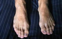 achillesheelart:  Beautiful toe tendons.