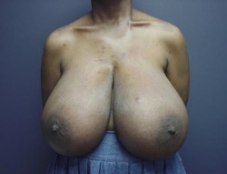 melvinblair:  Large grandma tits