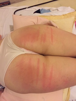 Stripes lingering after a caning that Paul gave me because it
