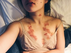 arielaphant:  Oops