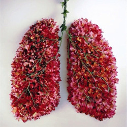 tmpls:  My lungs look like this except instead of flowers it’s