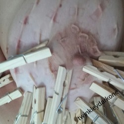 twinkleydarkone:  Removal of 50 clothespins.