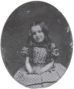 congenitaldisease:  In 1867, an 8-year-old girl named Fanny