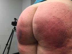 alexinspankingland:  I’m very sore today after my Real Spankings