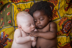 blazepress:A newborn albino baby sleeps peacefully with his cousin