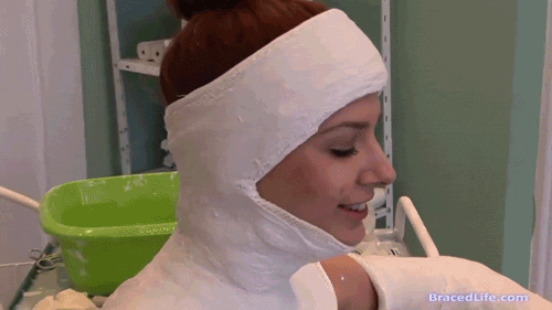 Minerva Body Cast with Double Long Arm Cast’s  (Medical Fetish & Bondage)from http://www.bracedlife.comtags: cast fetish pics, animated GIFs, sexy nurses in uniform, helpless female patient, hospital roleplay, body in plaster cast, wearing a cast,