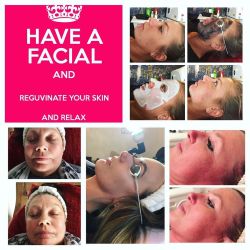 Book in for your carbon laser facials now working from Essex