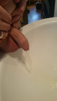 celticbear-getting-cut:  As requested  Last peeing before cut