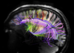 sagansense:  GPS-Like ‘Grid’ Cells Found In Human BrainScientists