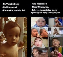   Unvaccinated  Vs Vaccinated children.